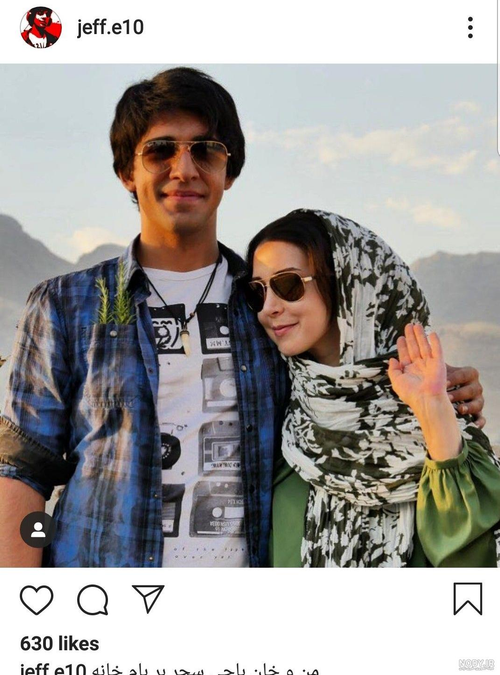 چرا صورت سحر جعفری جوزانی بر اثر تزریق بوتاکس کج شد؟ - تصویر ۹ - حاشیه‌ها